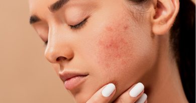 Acne Pimples Spots Zits Skin  - jmexclusives / Pixabay